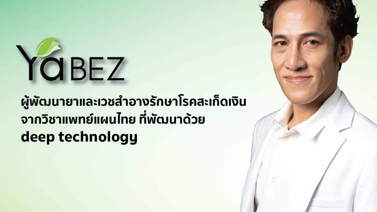 Yabez