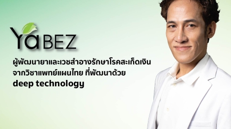 Yabez